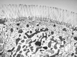 normal mucosa - jejunum - microvilli(anchored core rootlets) normal mucosa - jejunum - microvilli(anchored core rootlets)